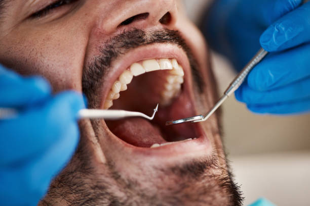 Best Emergency Dental Care for Trauma or Injury in Nicholson, MS