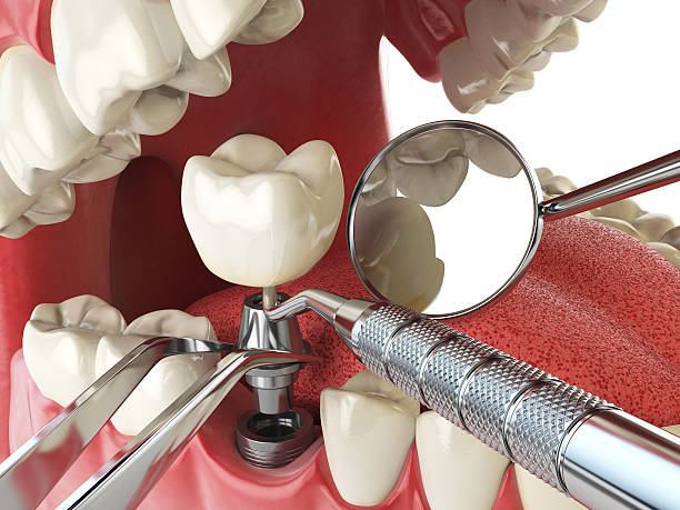 Best Emergency Dental Surgery in Nicholson, MS